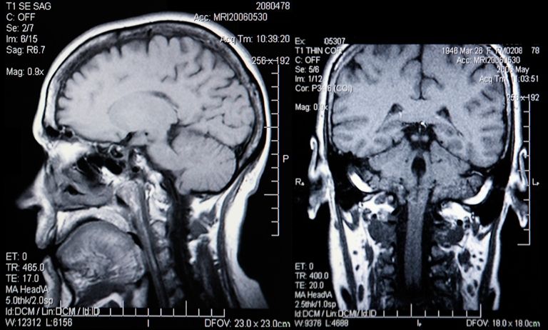 МРТ головного мозга - результаты сканирования - Сеть клиник АО Семейный доктор - Фото 1