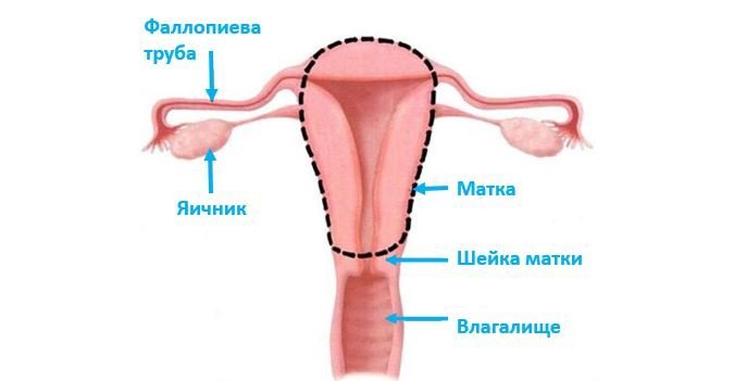 Надвлагалищная ампутация матки