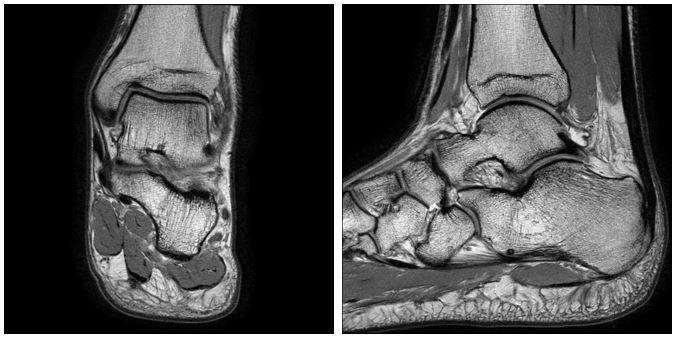 МРТ голеностопного сустава - Сеть клиник АО Семейный доктор - Изображение 1