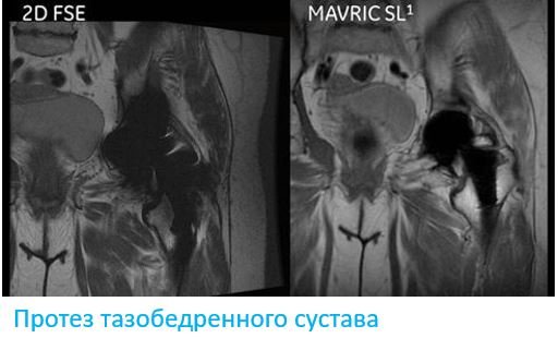 МРТ сустава с протезом - Сеть клиник АО Семейный доктор (Москва) - Изображение 1