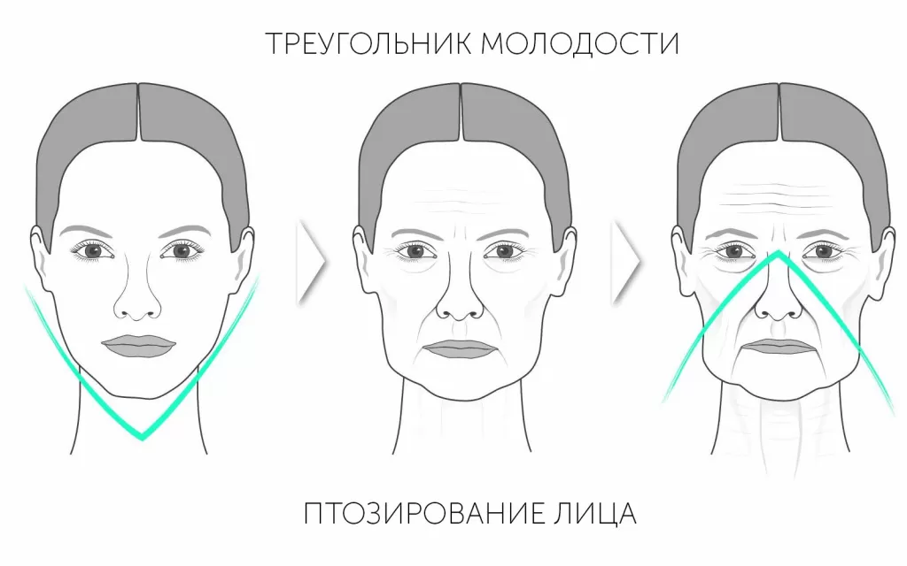 Круговая подтяжка лица - Сеть клиник АО Семейный доктор (Москва) - Изображение 1