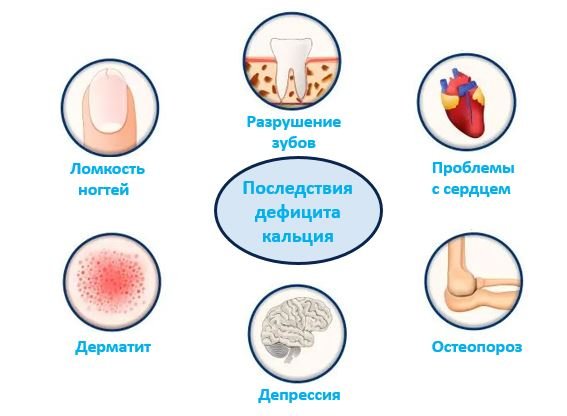 Дефицит кальция - Сеть клиник АО Семейный доктор (Москва) - Изображение 2